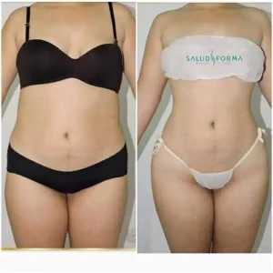 Nutricionista en Montería. Te ayudamos a cuidar tu salud y tu cuerpo 2 salud y forma 600x600 1