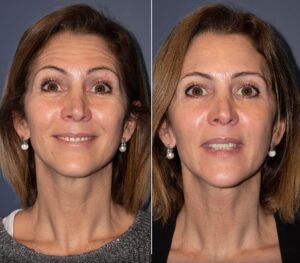 Médico Nutriólogo en Reynosa - Clínica de Nutrición Sole 13 484506780 9594136113972117 2280604903250623774 n